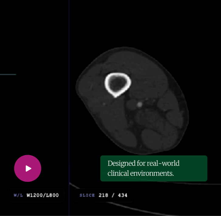 VascularAssist analysis of a clinical CT scan