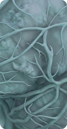 Vascular scan — Doppler waveform