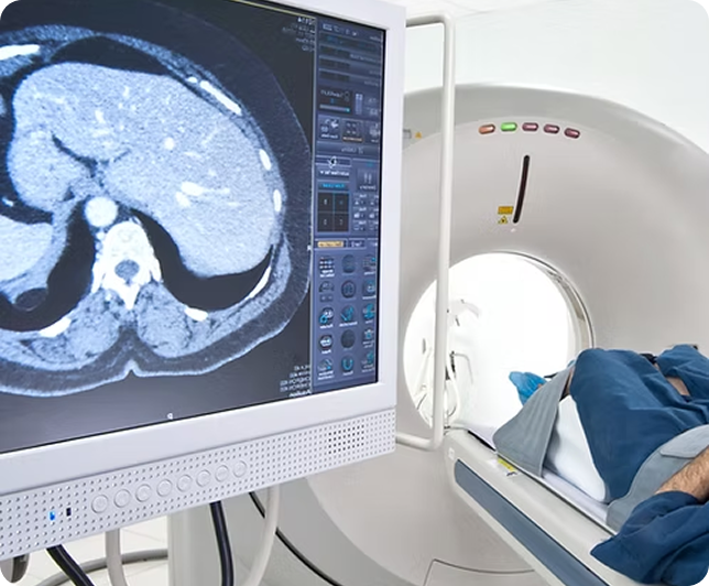 Brain scan imaging showing vascular markers